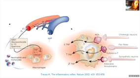 Case Studies Using Neural Therapy in the Management of Covid 19